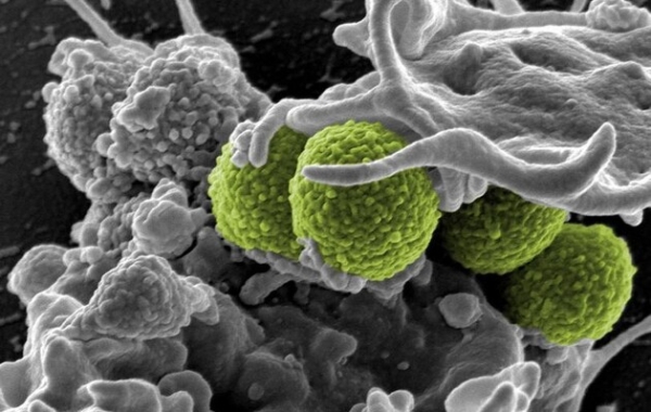 Вчені розробили антибіотик для боротьби зі стійкими до ліків бактеріями