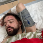 Викладача львівського університету знайшли під Києвом у критичному стані нібито після…