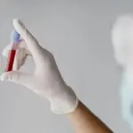 Гепатит А Київ — санслужби підтвердили десятки випадків у Відрадному