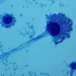 Прокляття фараонів тепер лікує рак – з грибка Aspergillus flavus синтезували ліки