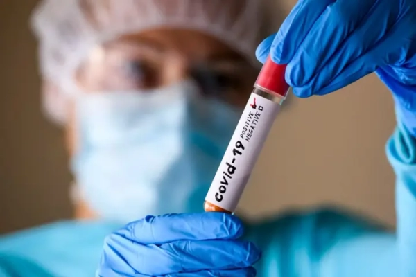 Кількість хворих на COVID-19 в Україні зросла більш ніж на 45% за тиждень