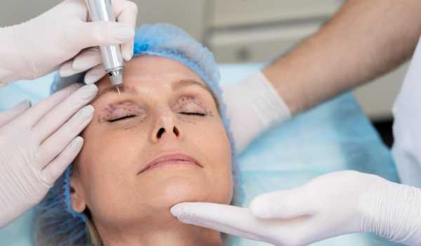 Підтяжка повік: який метод вибрати і що потрібно враховувати