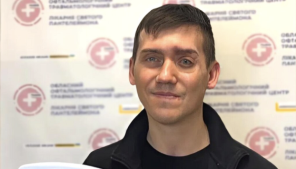 Доброволець з лицьовим екзопротезом: Люди не звертають уваги на відсутність ока.