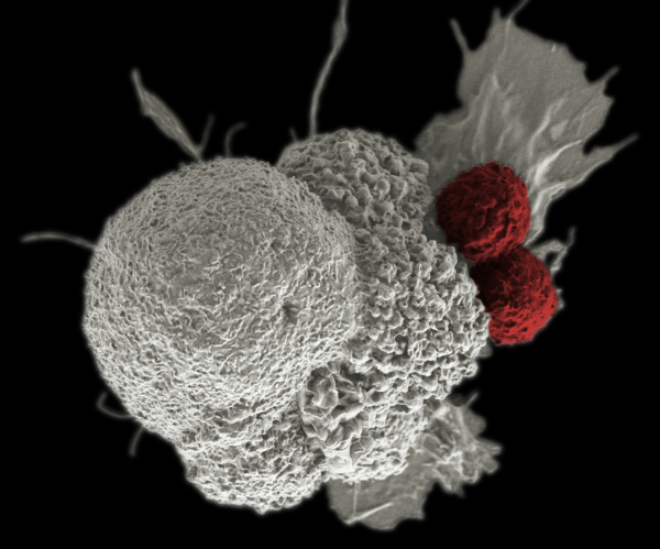 Дві T-клітини (зафарбовані червоним) атакують пухлину (білим). National Cancer Institute / Unsplash
