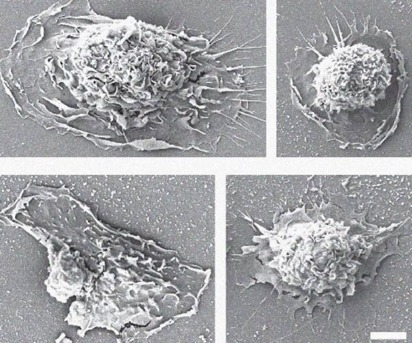 Новий підтип клітин під сканувальним електронному мікроскопом. Lim et al. / Nature Immunology, 2026