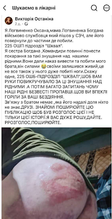Сідниці Богдана Логвиненка, побитого у 225-му полку